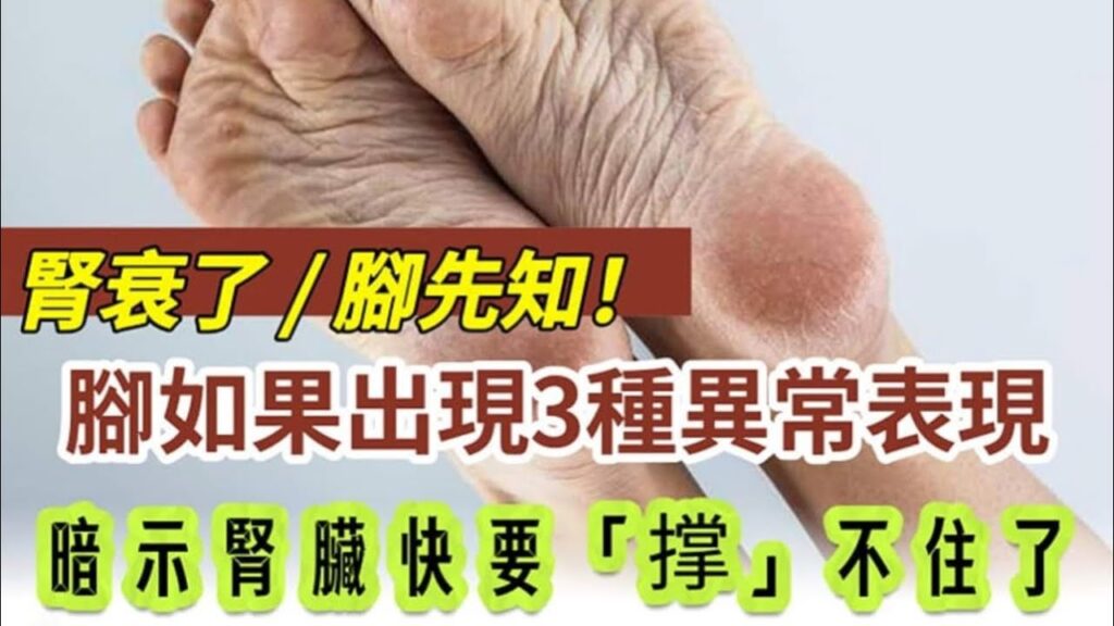 腎衰了，腳先知！腳出現「3種異常」表現，暗示腎臟快要「撐」不住了