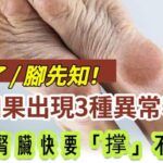 腎衰了，腳先知！腳出現「3種異常」表現，暗示腎臟快要「撐」不住了