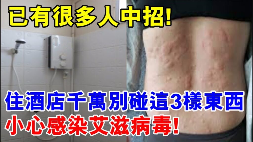 住酒店千萬不要碰這3樣東西，小心感染愛滋病毒！已有很多人中招!