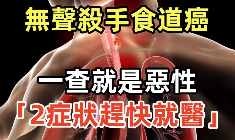 「無聲殺手」食道癌一查就是惡性！其實喉嚨早早給暗示「2症狀趕快就醫…」